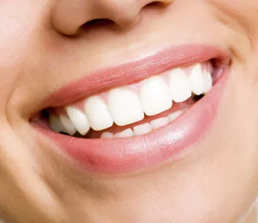 Sbiancamento | Studio dentistico Dott. N. Anton