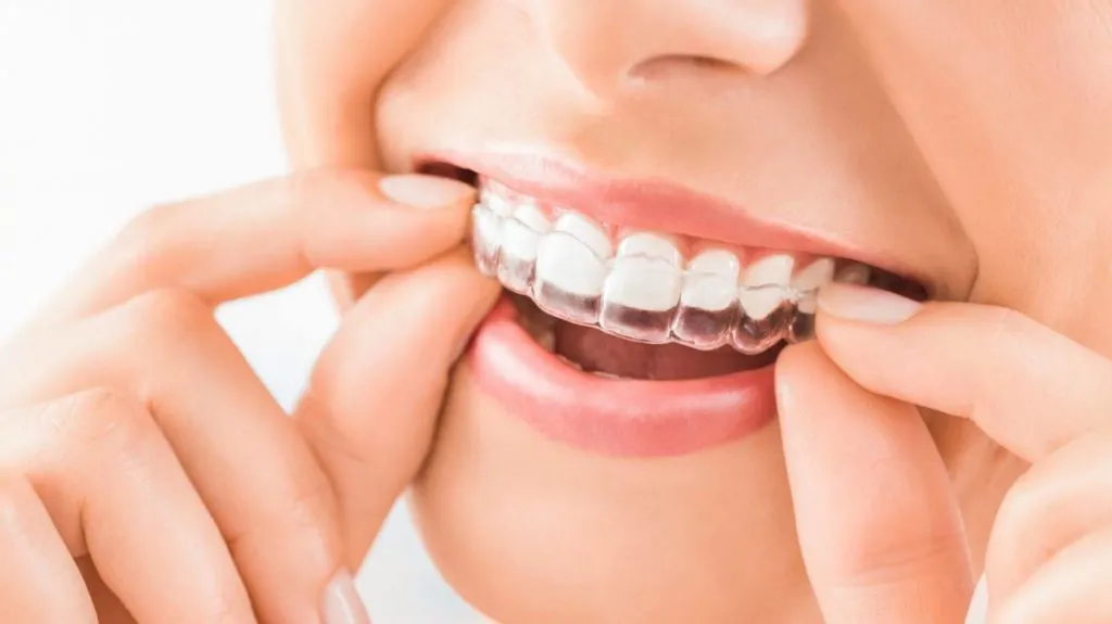 Ortodonzia | Studio dentistico Dott. N. Anton