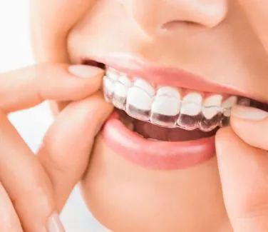 Ortodonzia | Studio dentistico Dott. N. Anton