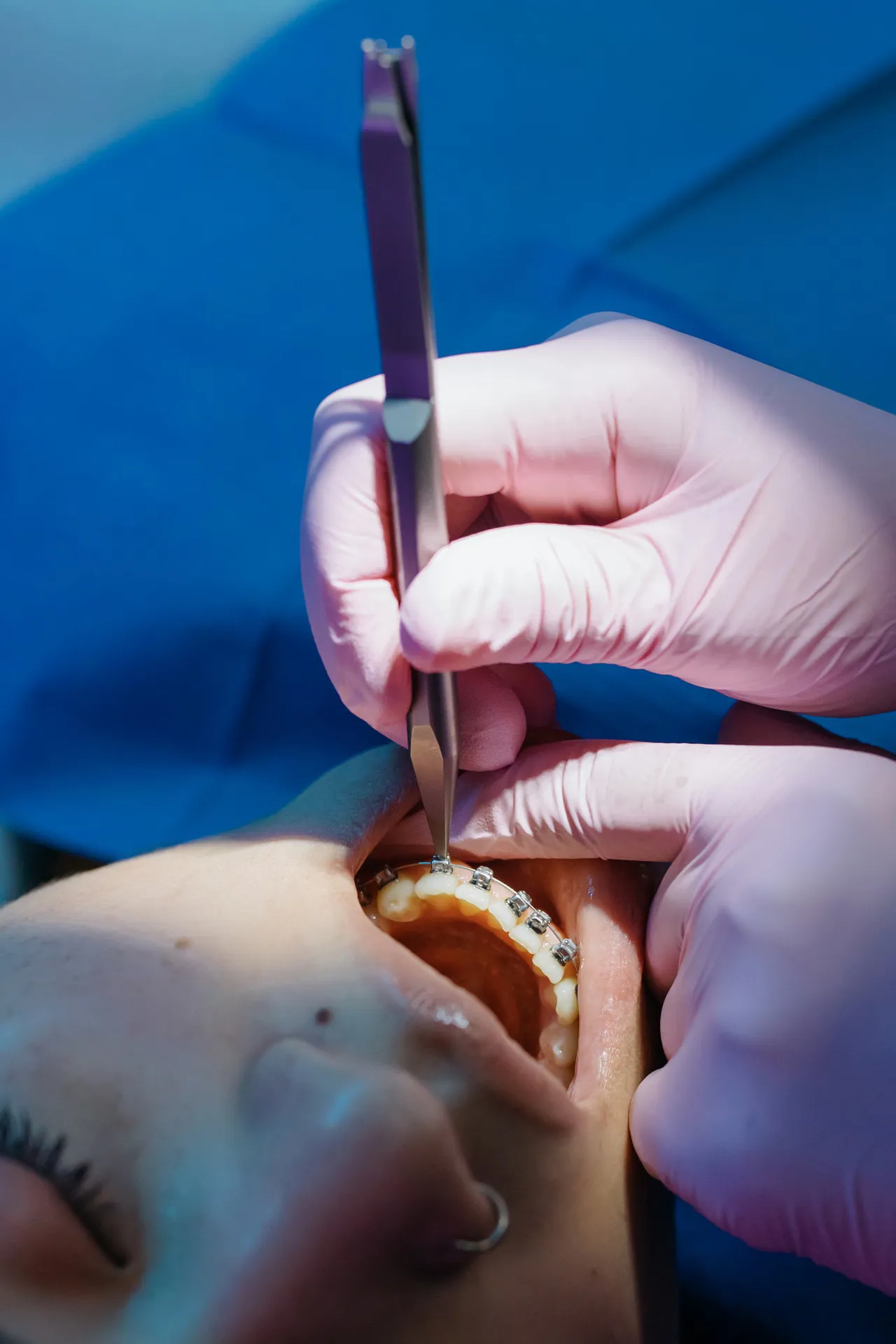 Odontoiatria estetica | Studio dentistico Dott. N. Anton