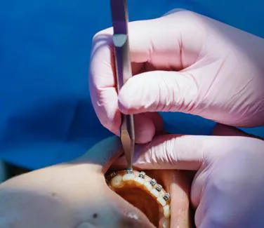 Odontoiatria estetica | Studio dentistico Dott. N. Anton