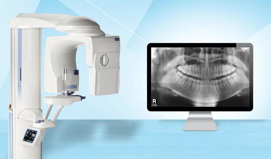 Radiografia standard | Studio dentistico Dott. N. Anton