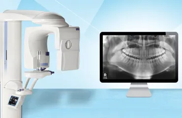 Radiografia standard | Studio dentistico Dott. N. Anton