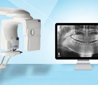 Radiografia standard | Studio dentistico Dott. N. Anton